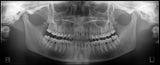 Panoura 18S Panoramic and CBCT Imaging Systems